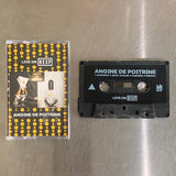 LIVE ON KEXP【TAPE】- ANGINE DE POITRINE